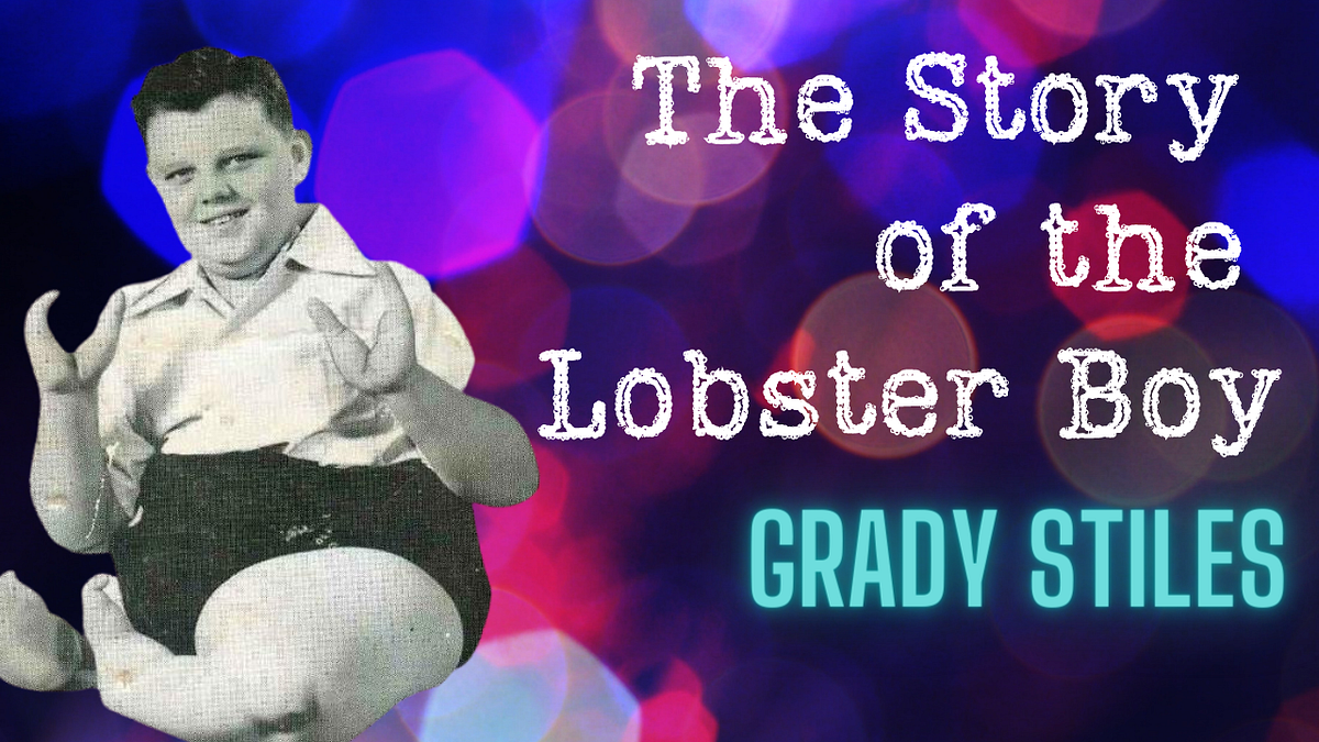 The Tragic Story of the “Freak Show” Lobster Boy, Grady Stiles by