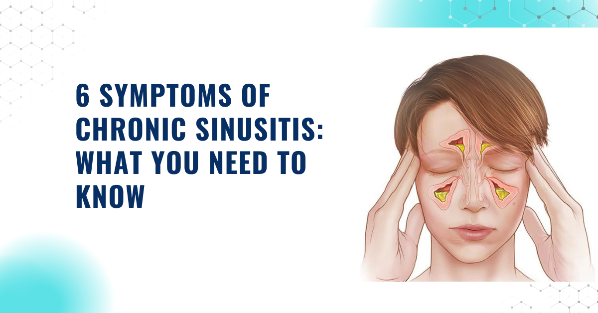Sinus: Causes & Symptoms