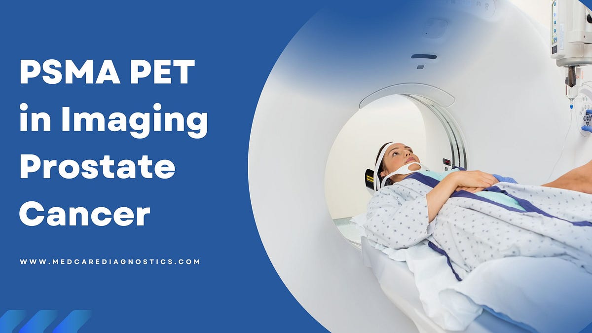 psma-pet-in-imaging-prostate-cancer-by-medcare-dignostics-medium