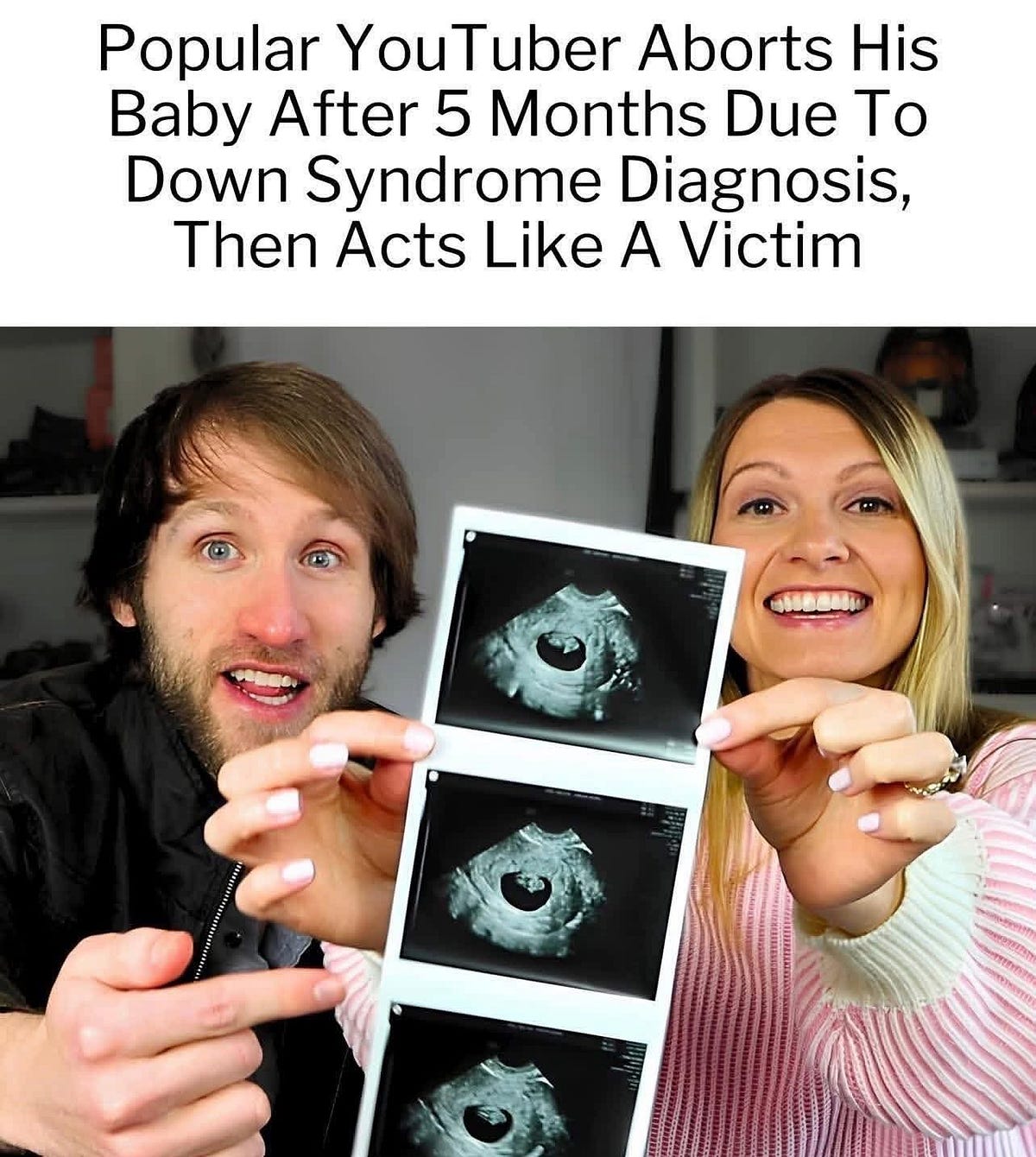 A media firestorm: Abortion, Eugenics, Ableism and Down Syndrome: The story of Jesse and Ashley