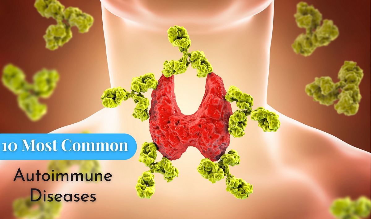 what-are-the-10-most-common-autoimmune-diseases-by-great-oral-health