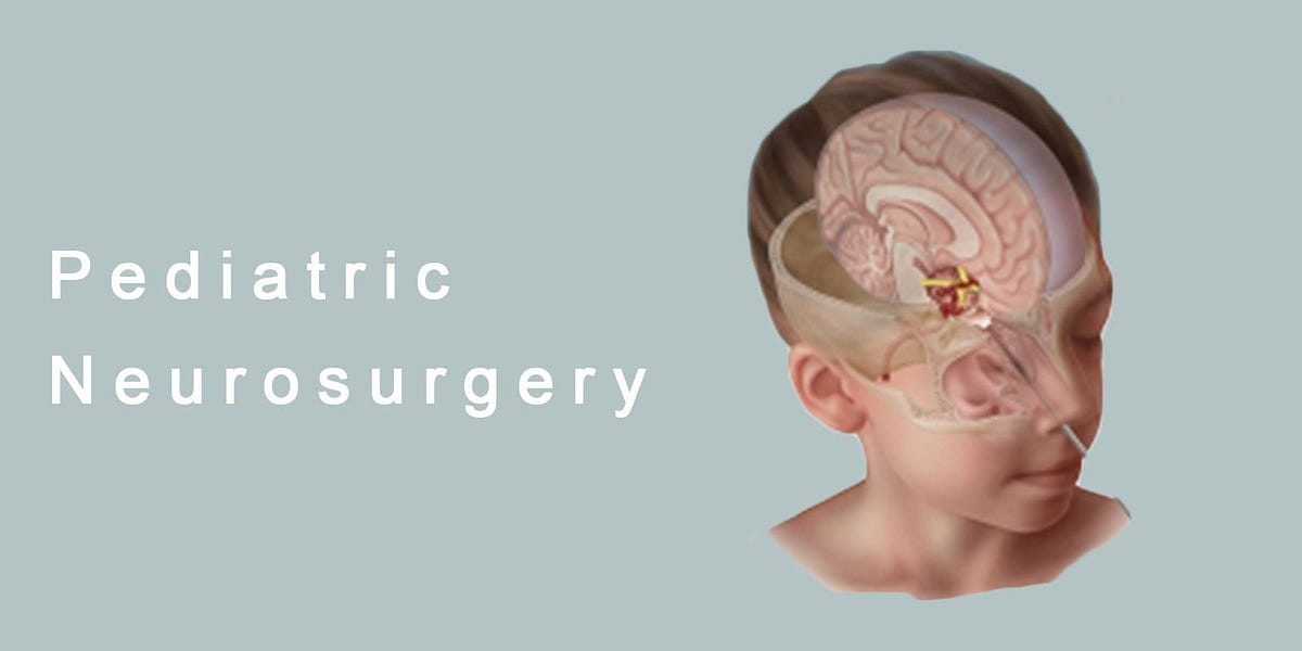 PEDIATRIC NEUROSURGERY. A subspeciality of neurosurgery… | by sinchan ...
