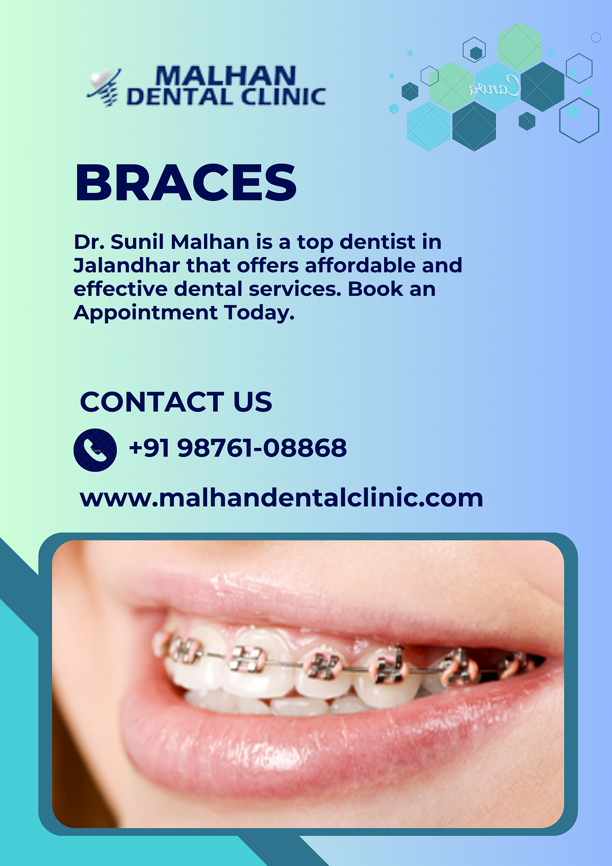 Best Braces Treatment in JalandharMalhan Dental Clinic Your