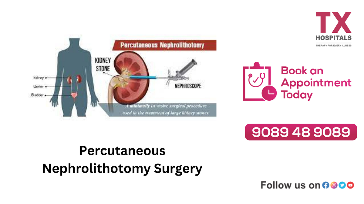Percutaneous Nephrolithotomy Surgery | by Kiranjyorhi Txhospitals | Medium