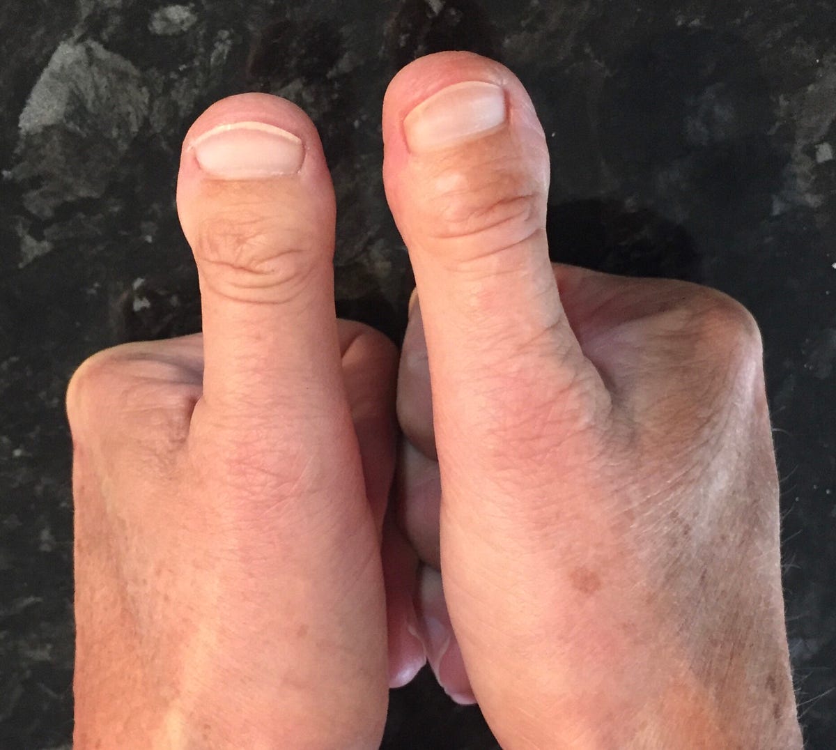 I Have Weird Thumbs. For most of my life, I’ve felt… by Lee Kelly