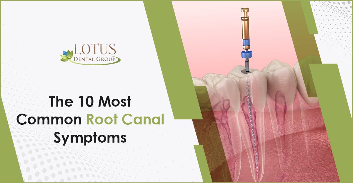 The 10 Most Common Root Canal Symptoms Recognizing the Need for