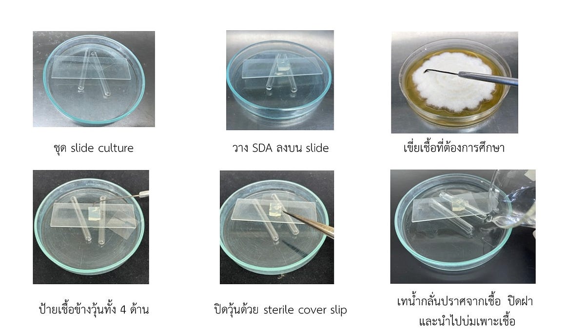 Slide culture technique. Slide culture technique หรือ Riddle’s… by