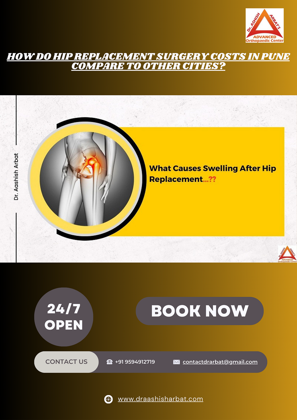 How do Hip Replacement Surgery Costs in Pune Compare to Other Cities
