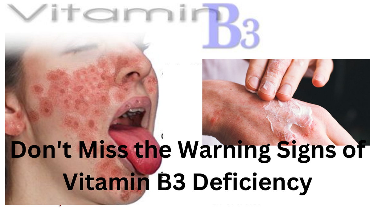 How to Identify Vitamin B3 Deficiency and Prevent It Naturally by