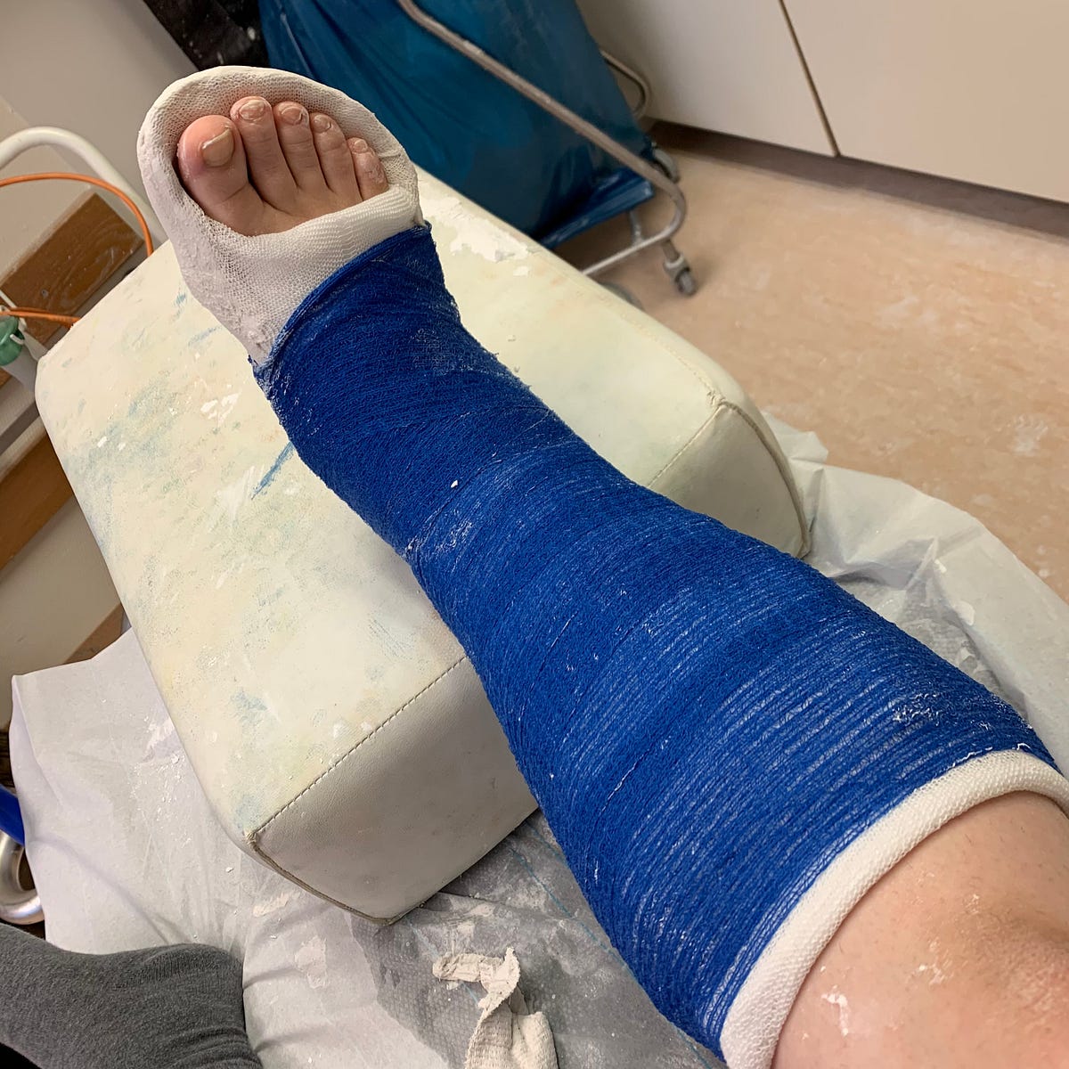 Medical Service in times of COVID19, or, how dare you break a bone now