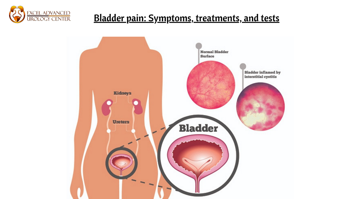 Bladder pain Symptoms, treatments and tests by Dr Ashish Saini Medium