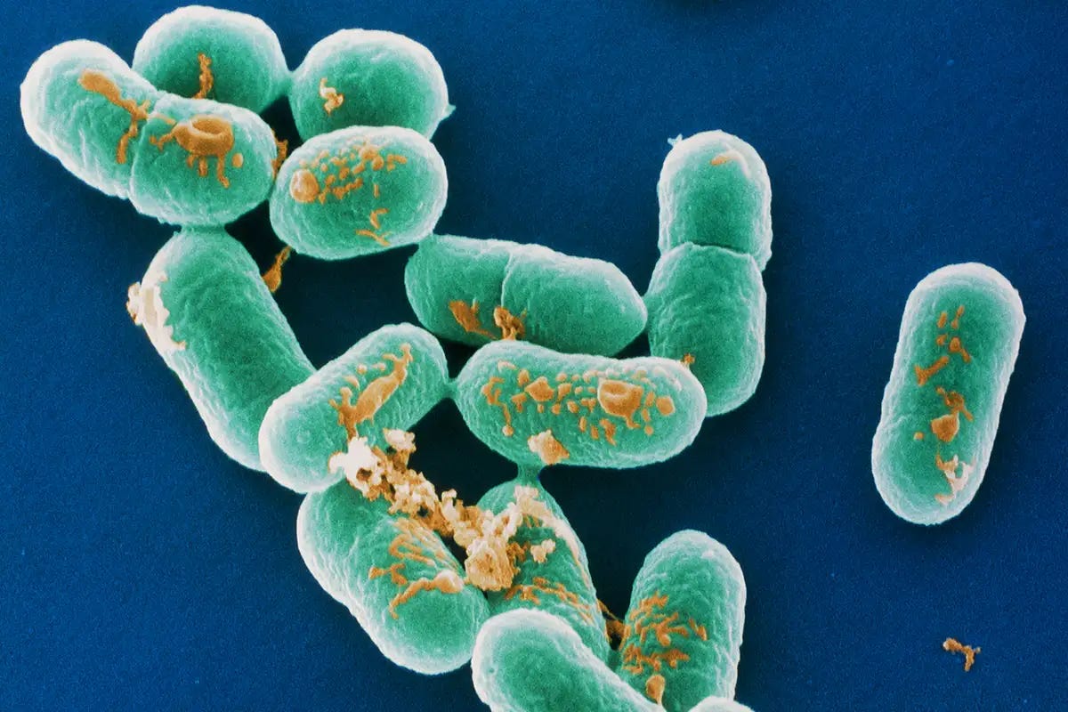 Major Retailers Issue Recalls Amid Deadly Listeria Outbreak Linked to