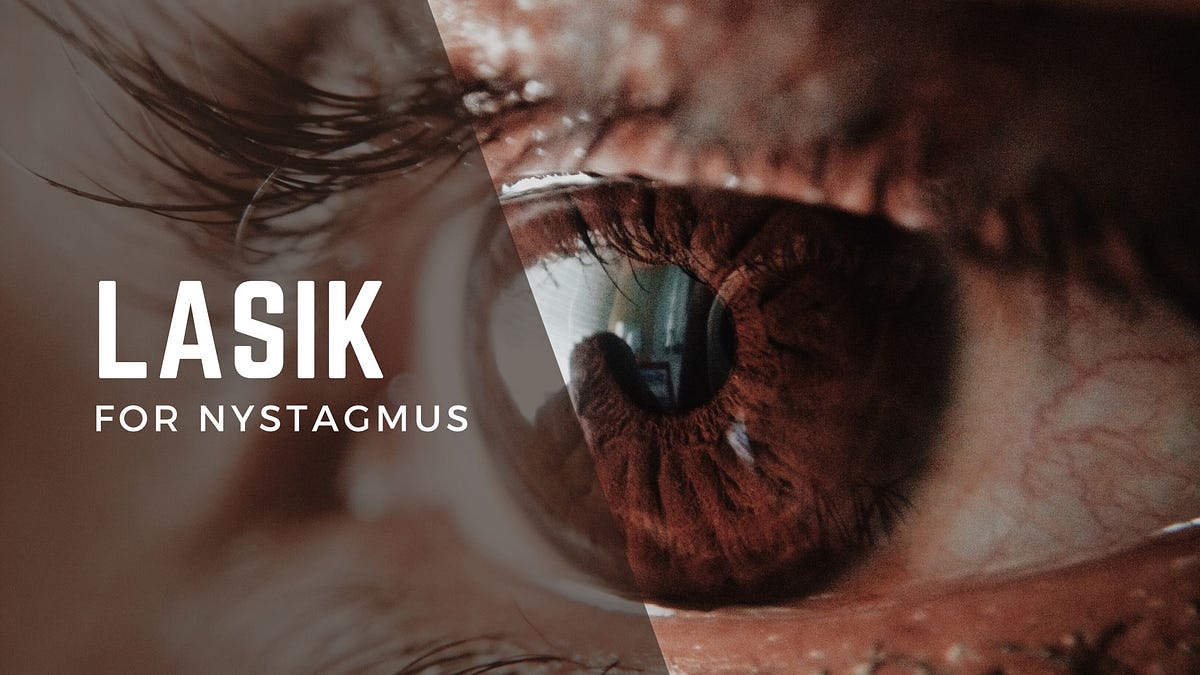 LASIK for Nystagmus. Nystagmus is a condition characterized… by Eye