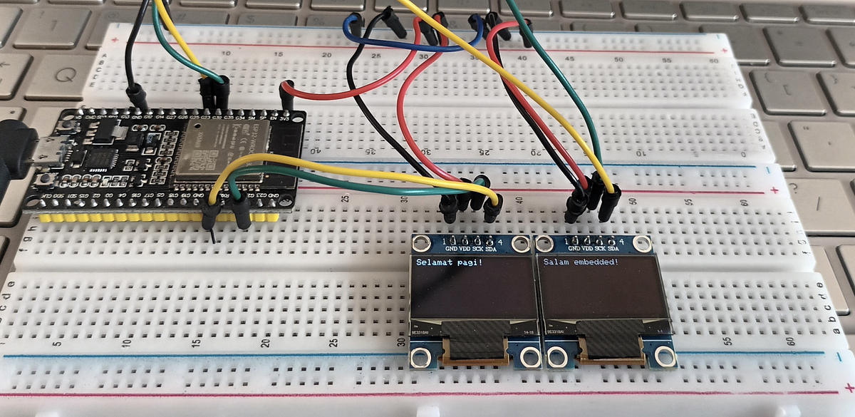 ESP32 | Serial Communication. Project 9 of Embedded System | by Nabilah ...