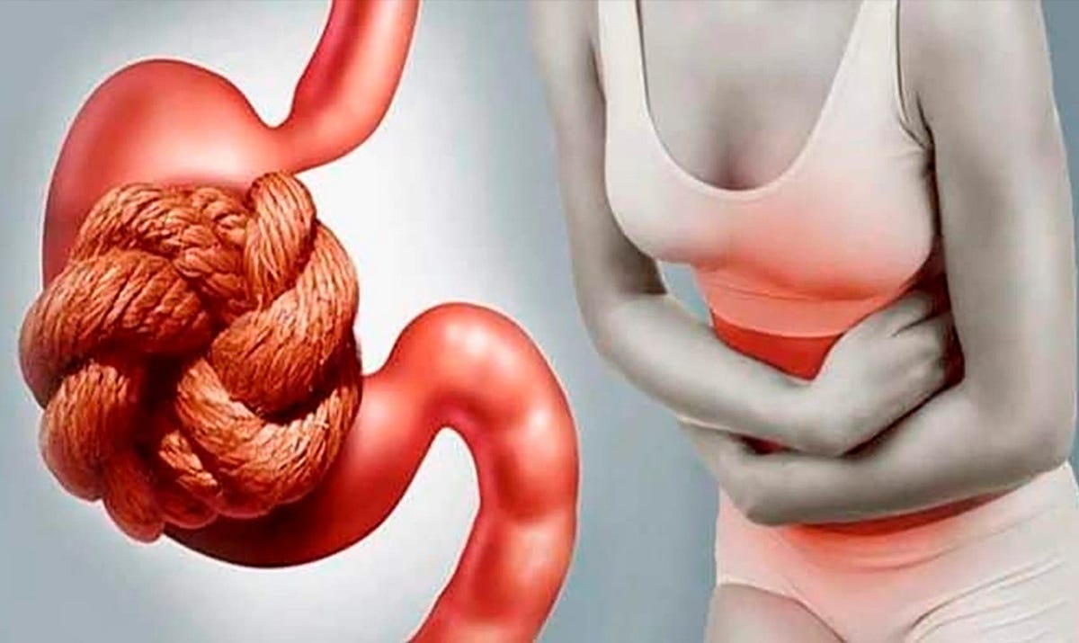 The Best Herbal Medicine for Chronic Constipation Herbal Medicine in Pakistan by Joe goldberg