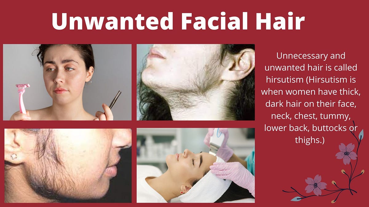 Unwanted Facial Hair. Unnecessary and unwanted hair is called… | by