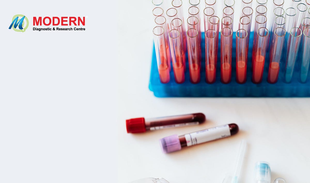 Blood Test at home Collection in Srinagar MDRC India Medium