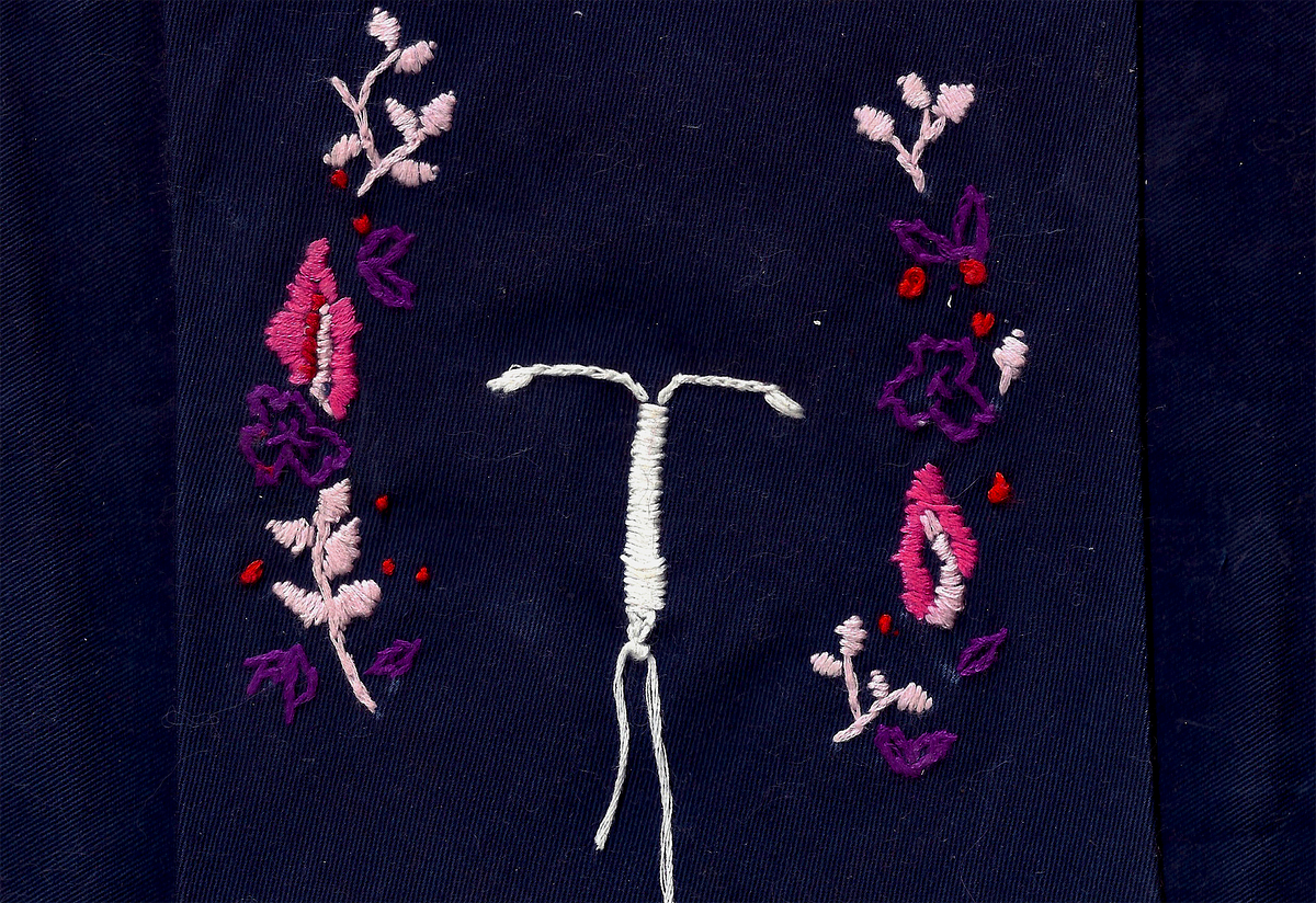 My Body Hates My IUD — But It Was Still Worth It
