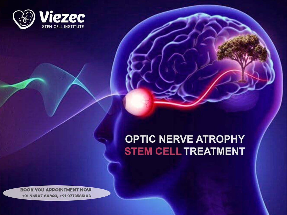 What Is Optic Nerve Atrophy Its Symptoms Causes Tests And Diagnosis what-is-optic-nerve-atrophy-its-symptoms-causes-tests-and-diagnosis
