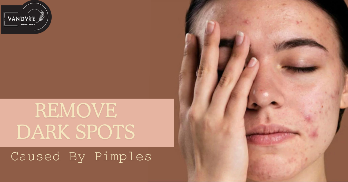 Remove Dark Spots Caused By Pimples by Vandyke Feb, 2024 Medium