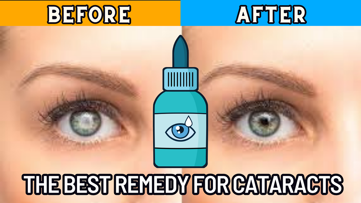 The Best Remedy for Cataracts How to Prevent Cataracts? by Gooindy
