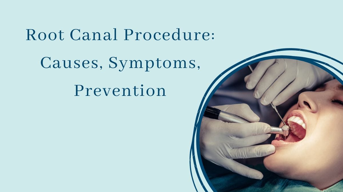 Root Canal Procedure Causes, Symptoms, Prevention by NV Aesthetics