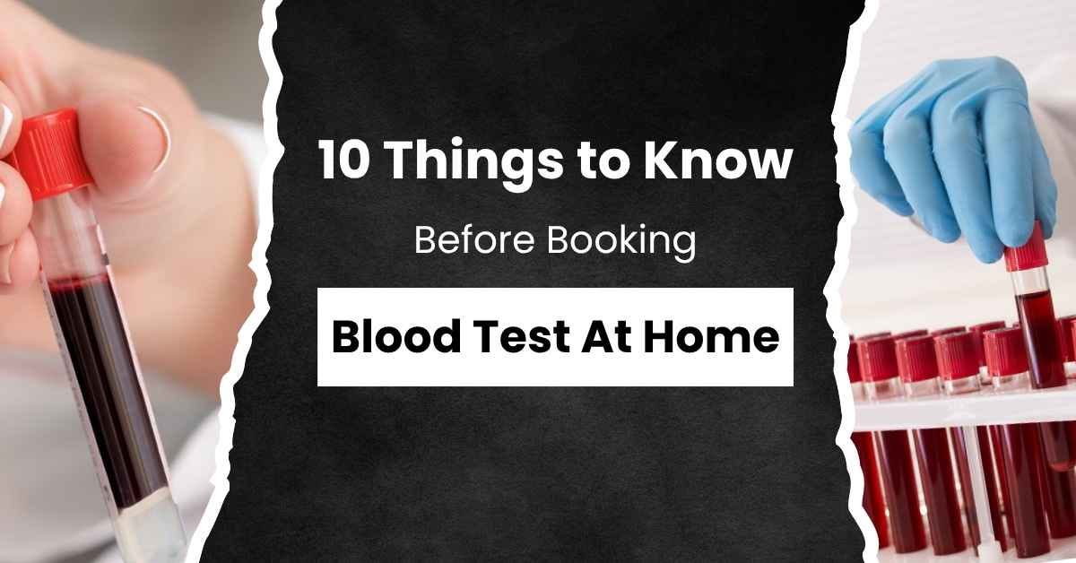 Things to Know Before Booking a Blood Test at Home