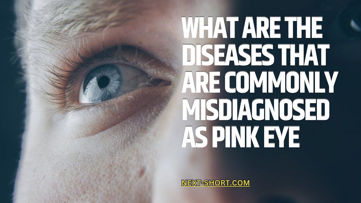 What Are the Diseases That Are Commonly Misdiagnosed as Pink Eye by Highpoint Taylor Jul