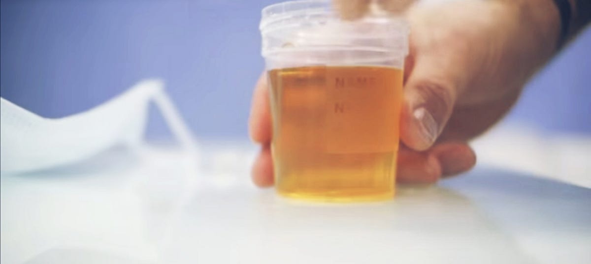 Why Does Your Urine Smell Like Popcorn (7 Common Causes & When to See