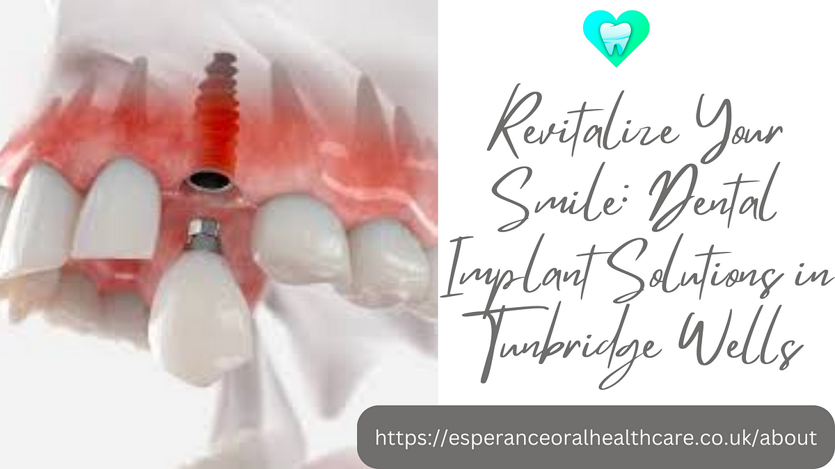 Revitalize Your Smile Dental Implant Solutions In Tunbridge Wells