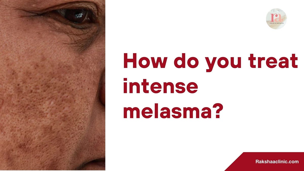 What is hair doctor called? Rakshaa_clinic Medium