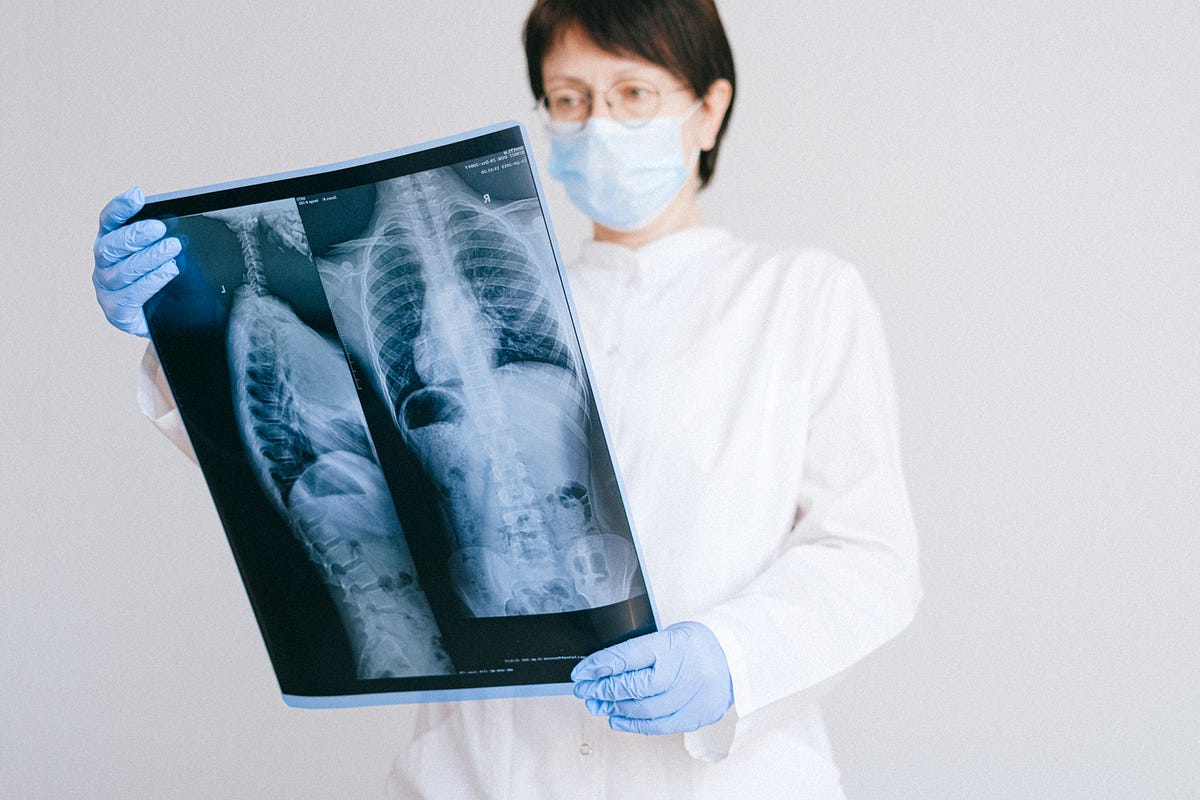 Are X rays Bad for You ?. Let’s start from the basic. What does… by