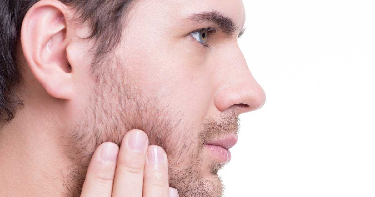 Battling Beard Acne: Top 4 Causes, Treatment, and Prevention | by Samir  Aghayev | Medium