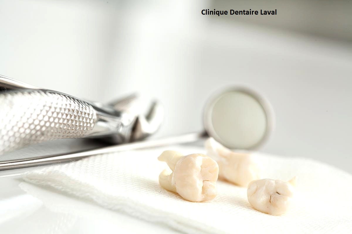 Implant dentaire Tunisie !. Il vous est difficile de sourire en… by