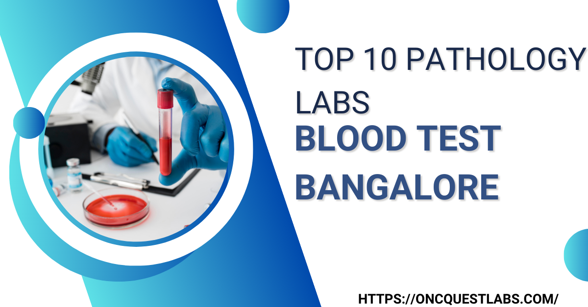 Top 10 pathology labs blood test Bangalore by Oncquestlabs Apr