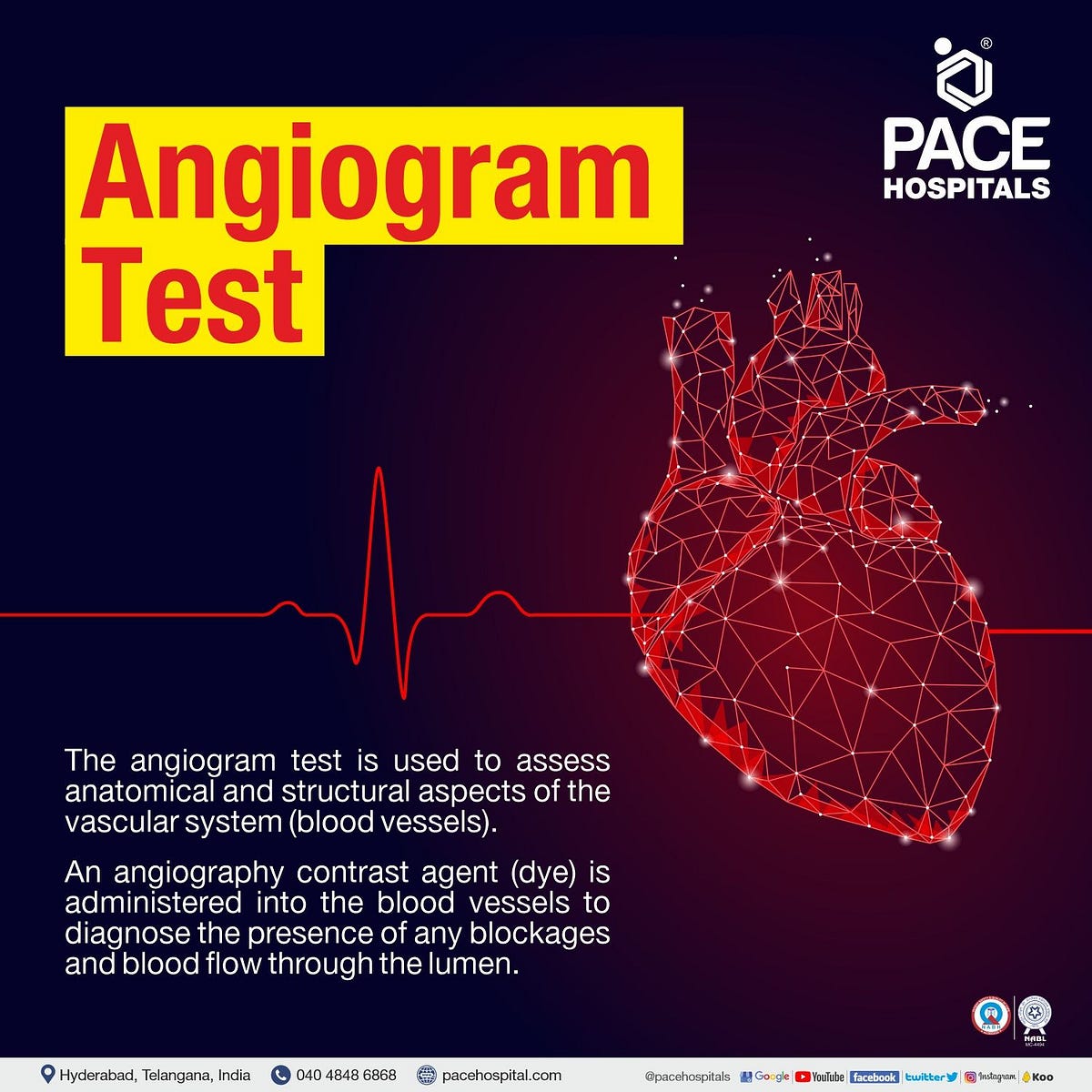 angiogram-procedure-in-hyderabad-pace-hospitals-has-one-of-the