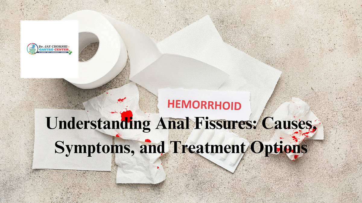 Understanding Anal Fissures Causes Symptoms And Treatment Options By Gastro Surgery Surat 9939