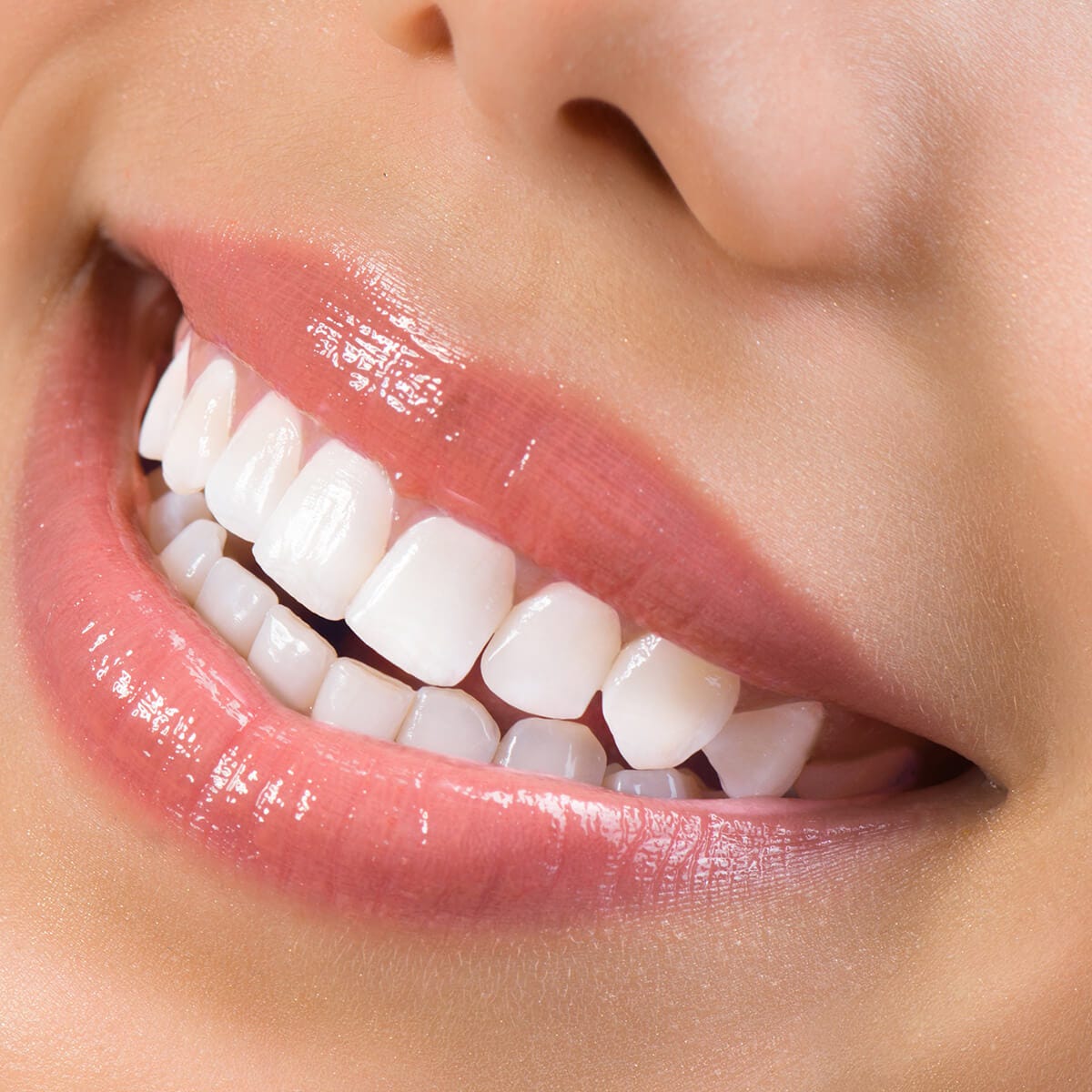 Veneers In London, Ontario Enhance Your Smile Today by INGERSOLL DENTAL CENTRE Oct, 2023
