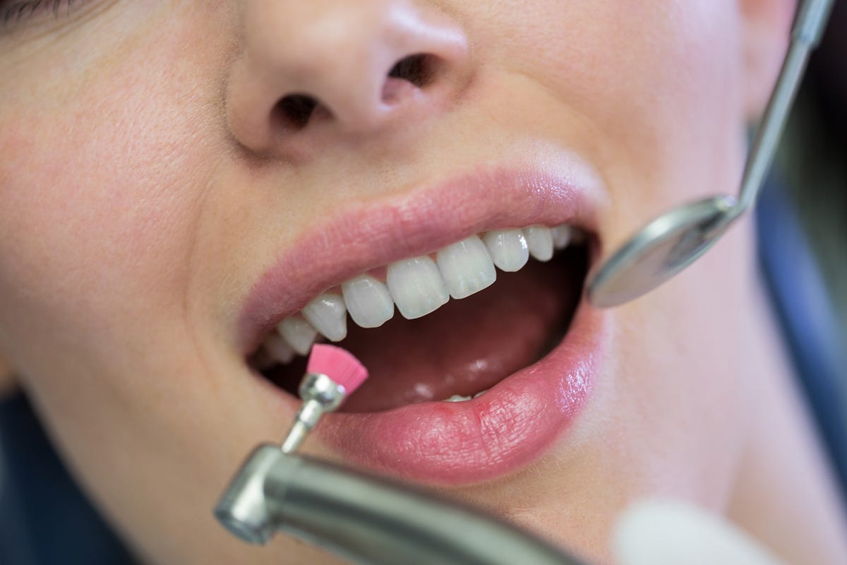 How To Tell When You Need a Tooth Filling? by roycedental Nov, 2023 Medium