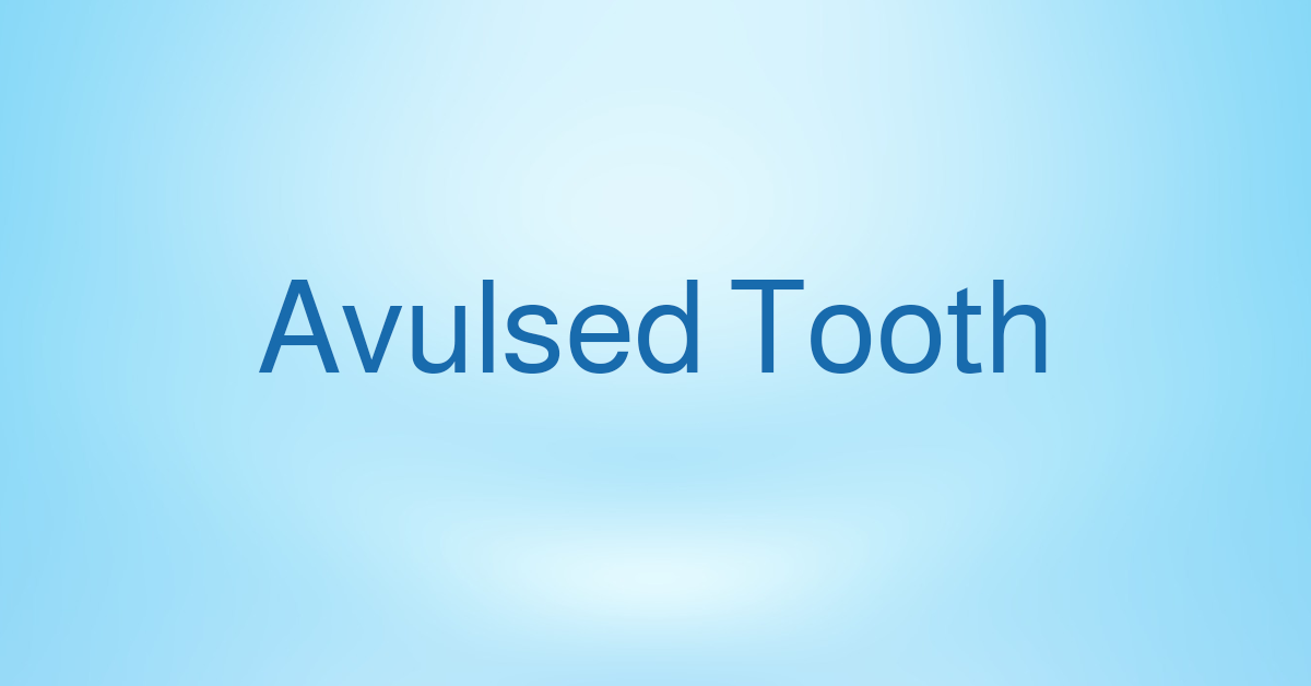 Avulsed Tooth. A tooth avulsion occurs when your… by Kayşehir dental