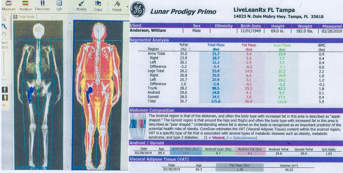 New Technology Perfectly Measures Your Body Fat
