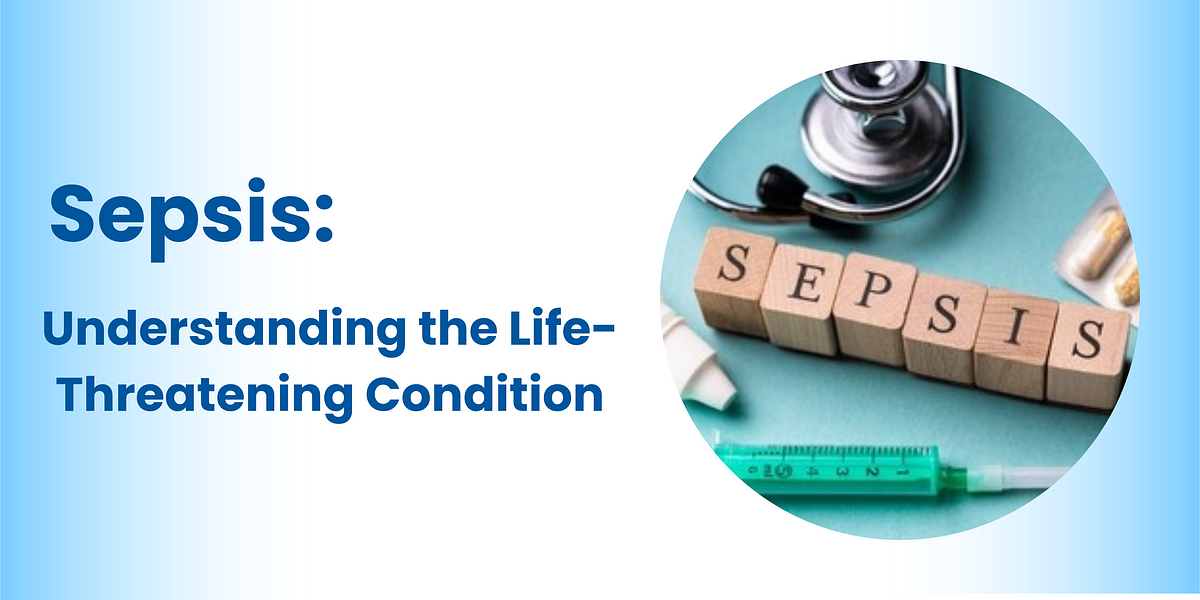 Sepsis: Understanding the Life-Threatening Condition  by Shamna Sherin 