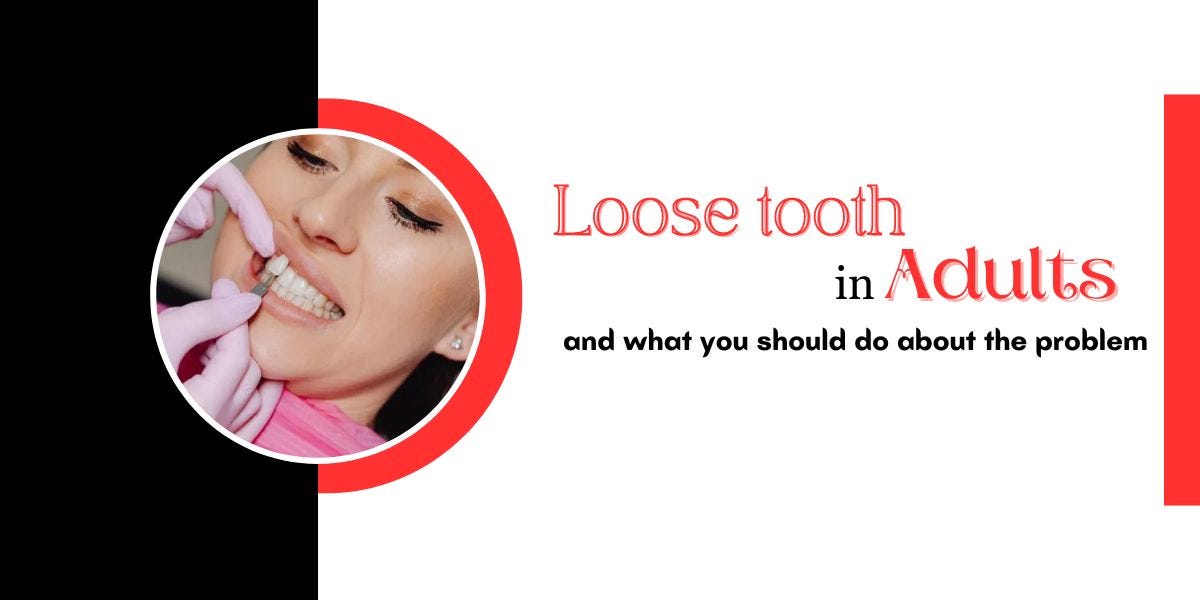 Loose Tooth In Adults And What You Should Do About The Problem Emergency Dentist London Pro