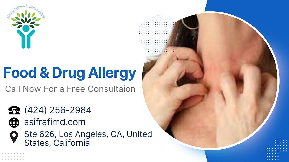 Unveiling New Treatment Options for Drug Allergies in Los Angeles