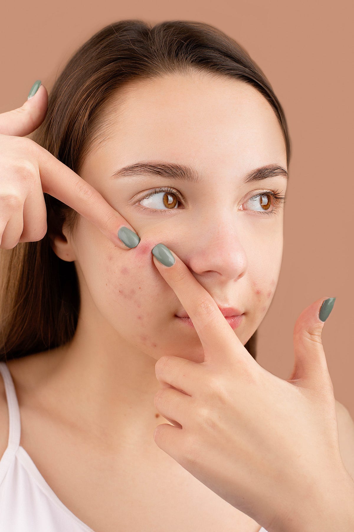 is-your-skincare-giving-you-pimples-by-shumon-express-medium