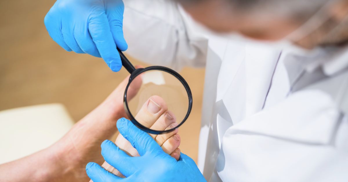 Why Do Toenails Turn Yellow? Medium