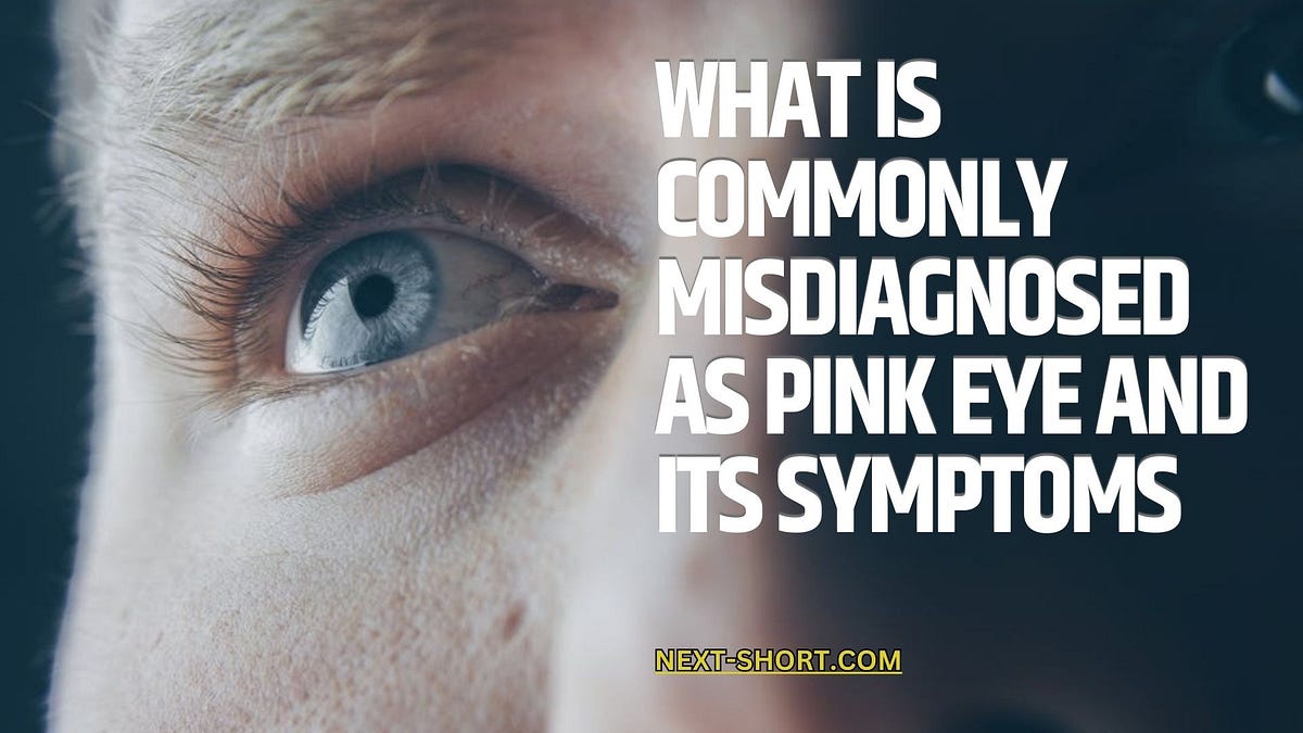 What Is Commonly Misdiagnosed as Pink Eye and Its Symptoms by Stephen Hulsebos Jul, 2024
