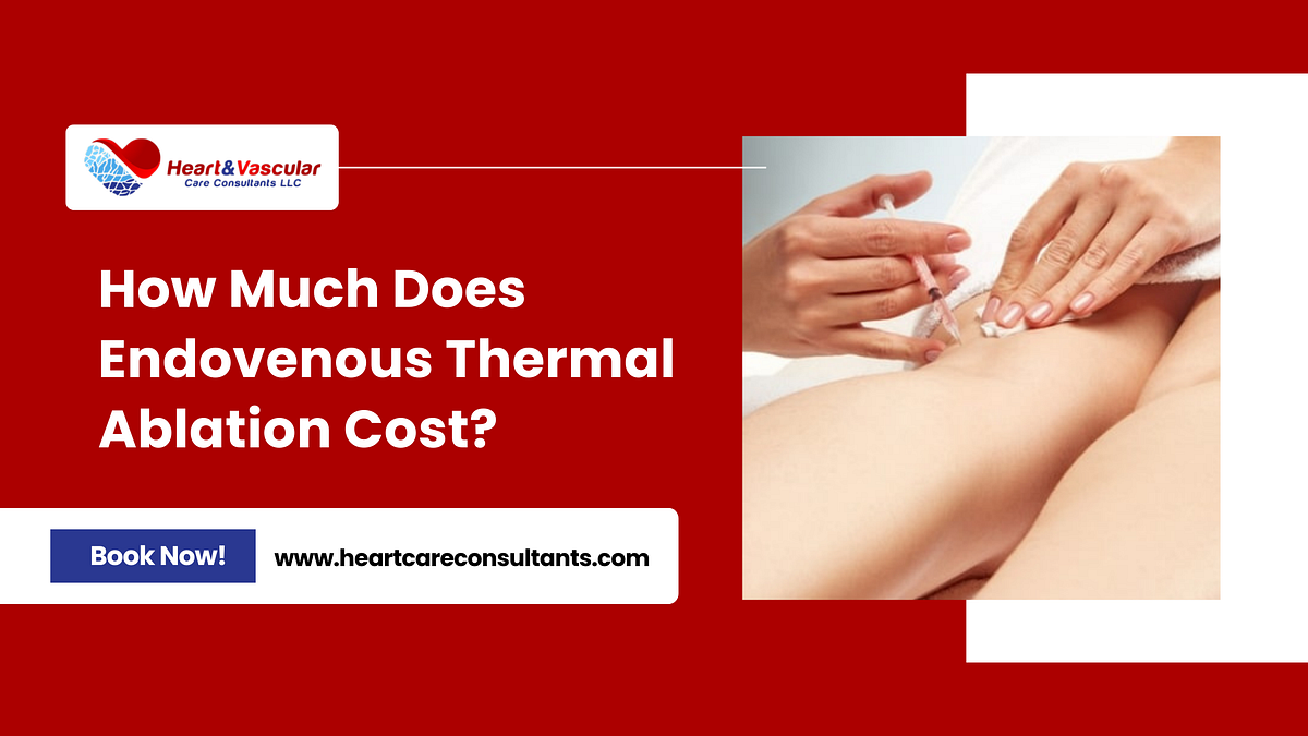 How Much Does Endovenous Thermal Ablation Cost? by Heart and Vascular