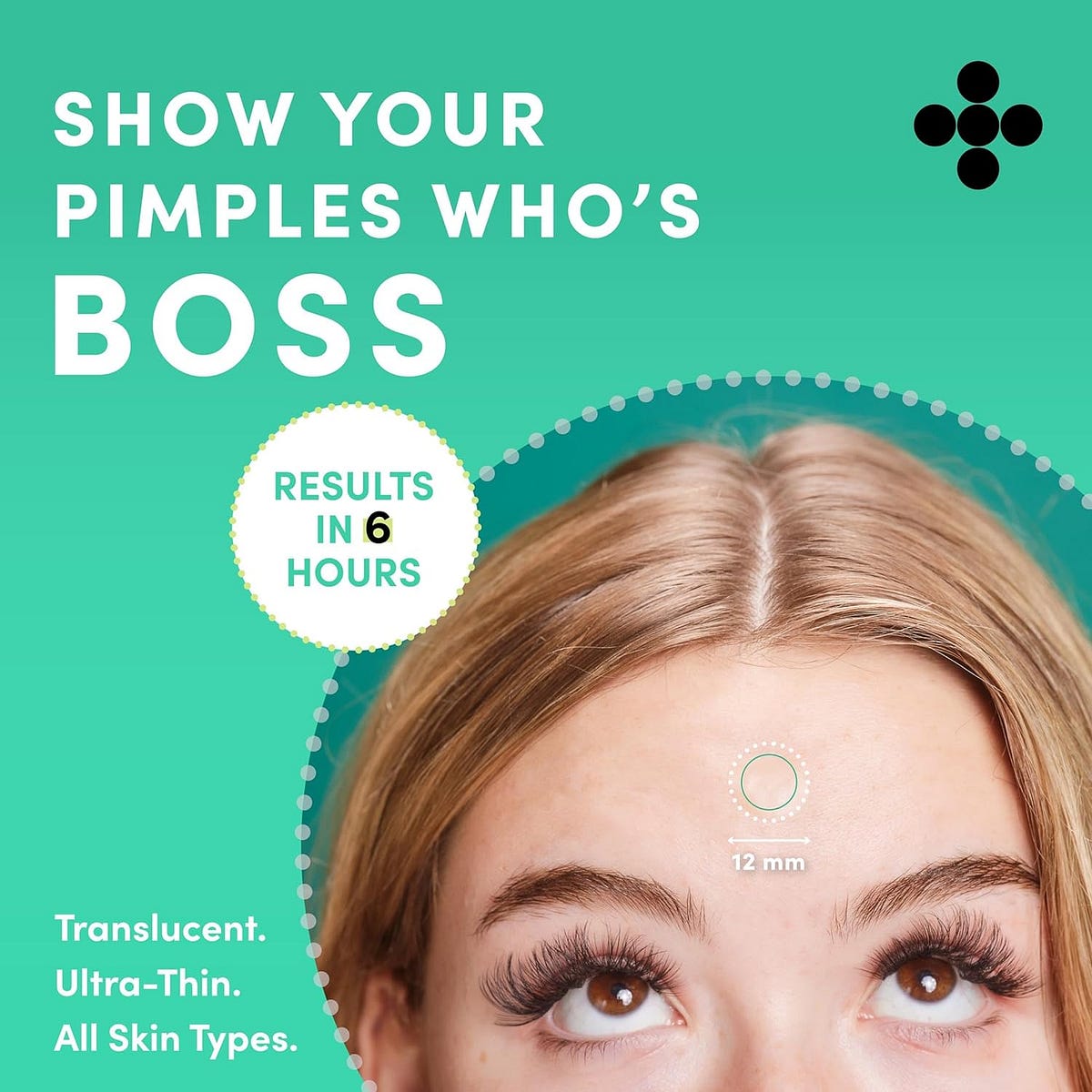 The Game Changing Solution; Dots, for Spots Acne Patches by GurdevS