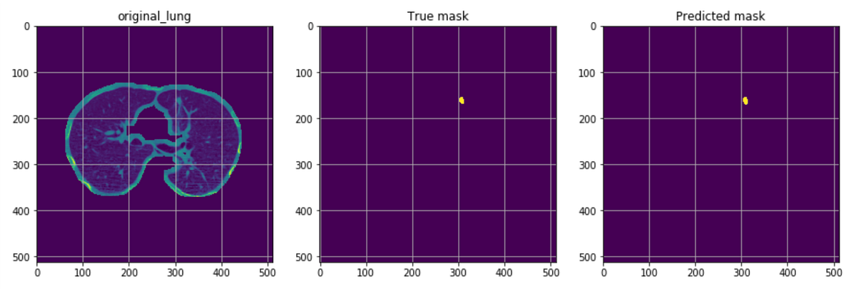 How to start your very first Lung-Cancer Detection project using Python ...